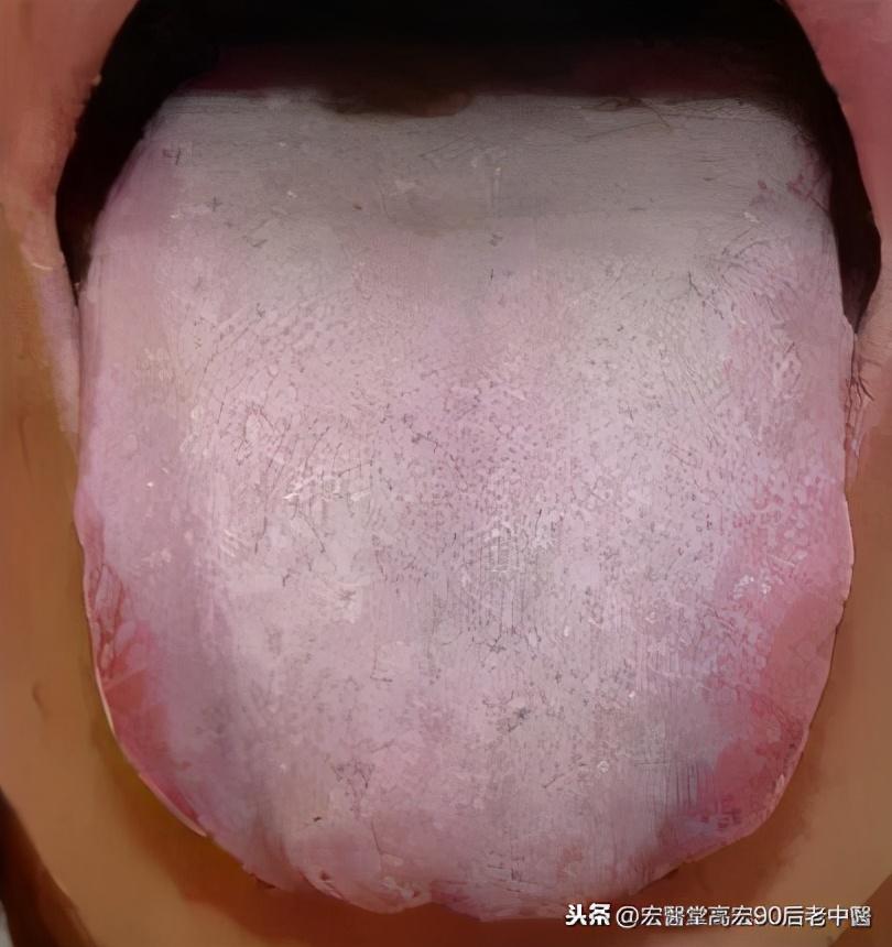 第1132页
